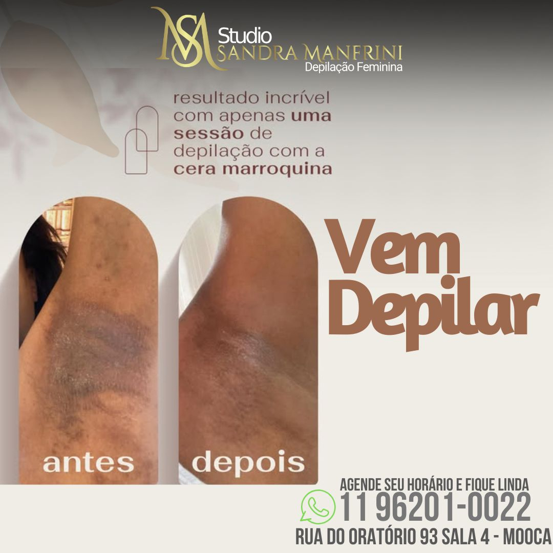 Vem depilar-Resultados incríveis com a Cera Marroquina